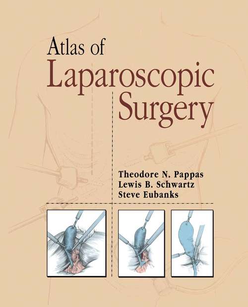 Book cover of Atlas of Laparoscopic Surgery (1996)