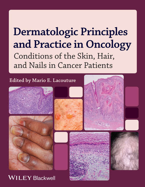 Book cover of Dermatologic Principles and Practice in Oncology: Conditions of the Skin, Hair, and Nails in Cancer Patients