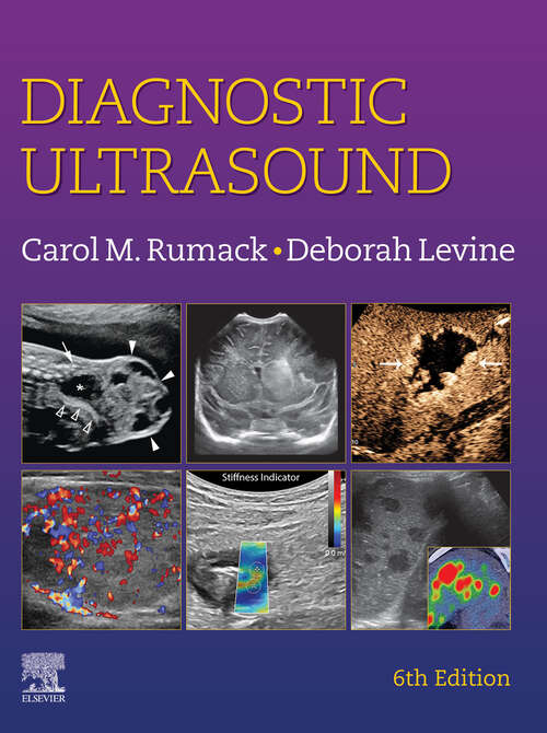 Book cover of Diagnostic Ultrasound