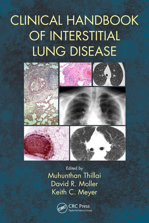 Book cover of Clinical Handbook of Interstitial Lung Disease