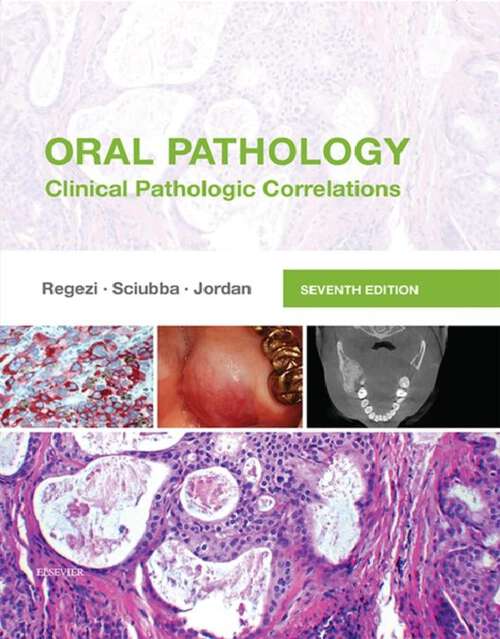 Book cover of Oral Pathology - E-Book: Oral Pathology - E-Book (7)