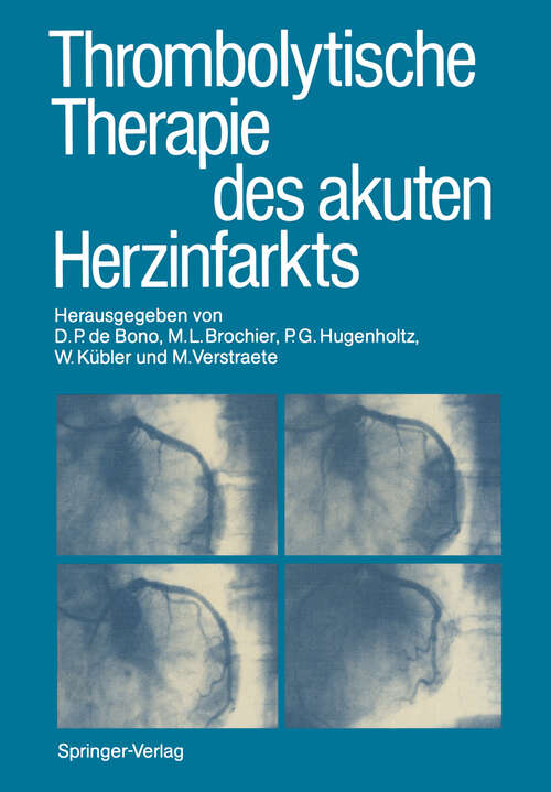 Book cover of Thrombolytische Therapie des akuten Herzinfarkts (1987)