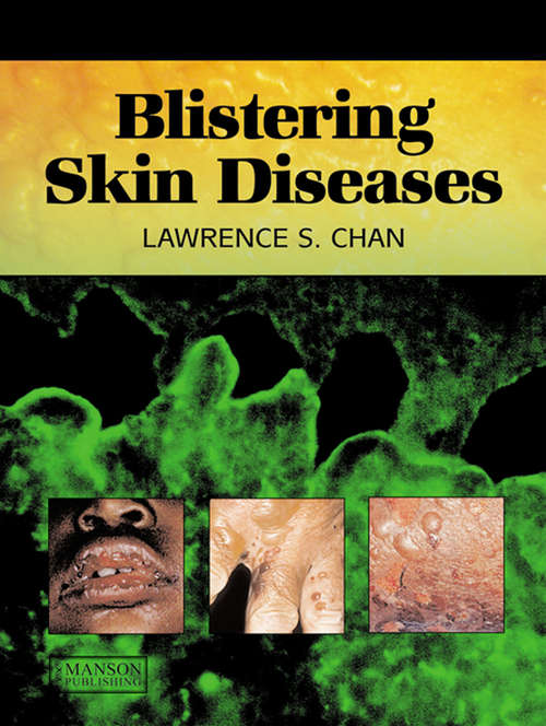 Book cover of Blistering Skin Diseases