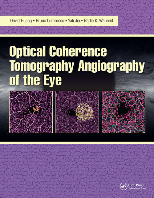 Book cover of Optical Coherence Tomography Angiography of the Eye: OCT Angiography