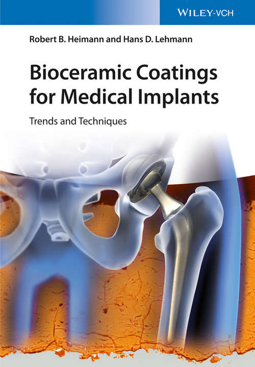 Book cover of Bioceramic Coatings for Medical Implants: Trends and Techniques