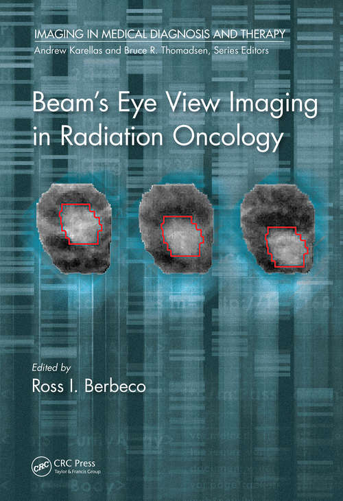 Book cover of Beam's Eye View Imaging in Radiation Oncology (Imaging in Medical Diagnosis and Therapy)