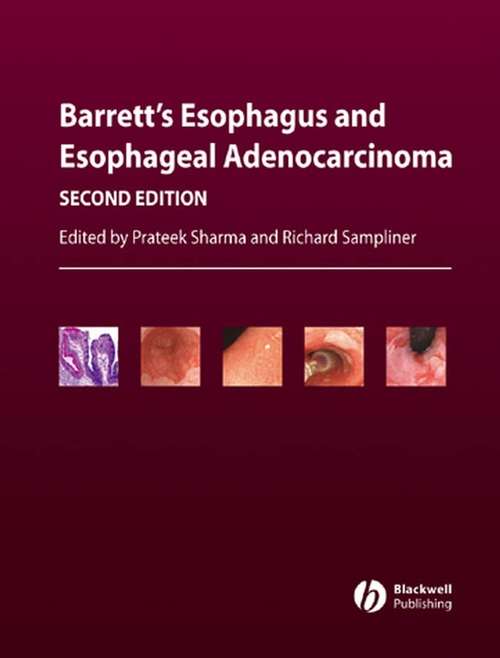 Book cover of Barrett's Esophagus and Esophageal Adenocarcinoma (2)