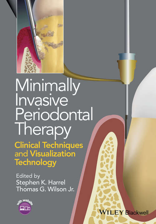 Book cover of Minimally Invasive Periodontal Therapy: Clinical Techniques and Visualization Technology