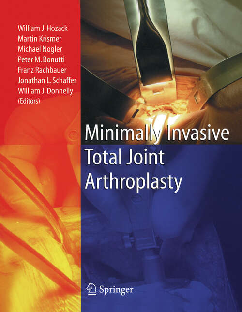 Book cover of Minimally Invasive Total Joint Arthroplasty (2004)