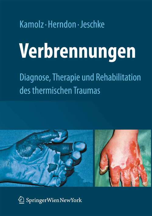 Book cover of Verbrennungen: Diagnose, Therapie und Rehabilitation des thermischen Traumas (2009)