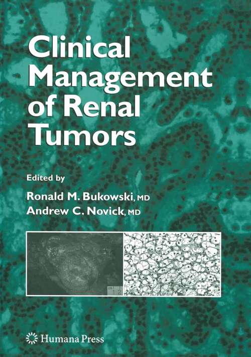 Book cover of Clinical Management of Renal Tumors (2008)