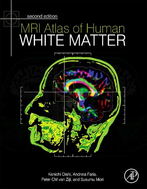 Book cover of MRI Atlas of Human White Matter (2)