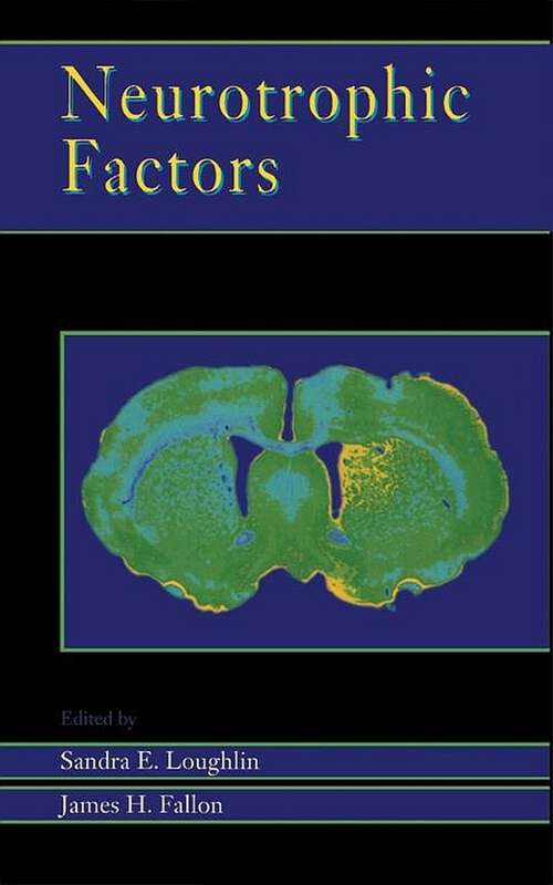 Book cover of Neurotrophic Factors