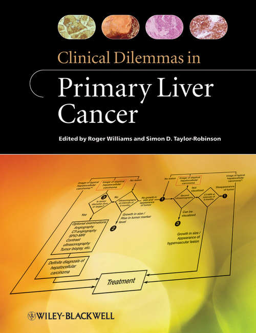 Book cover of Clinical Dilemmas in Primary Liver Cancer (Clinical Dilemmas (UK) #5)