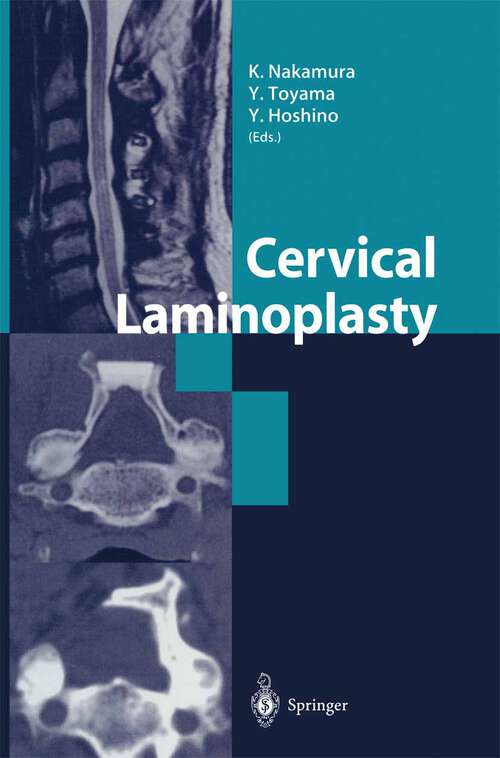 Book cover of Cervical Laminoplasty (2003)