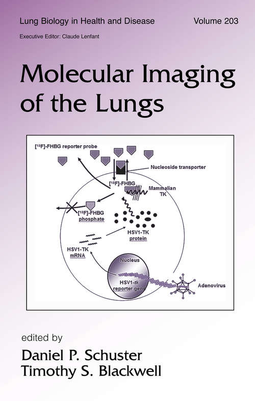 Book cover of Molecular Imaging of the Lungs