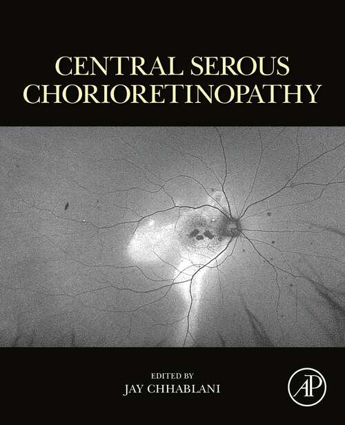 Book cover of Central Serous Chorioretinopathy