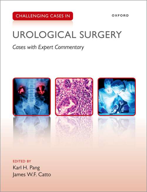 Book cover of Challenging Cases in Urological Surgery (Challenging Cases)