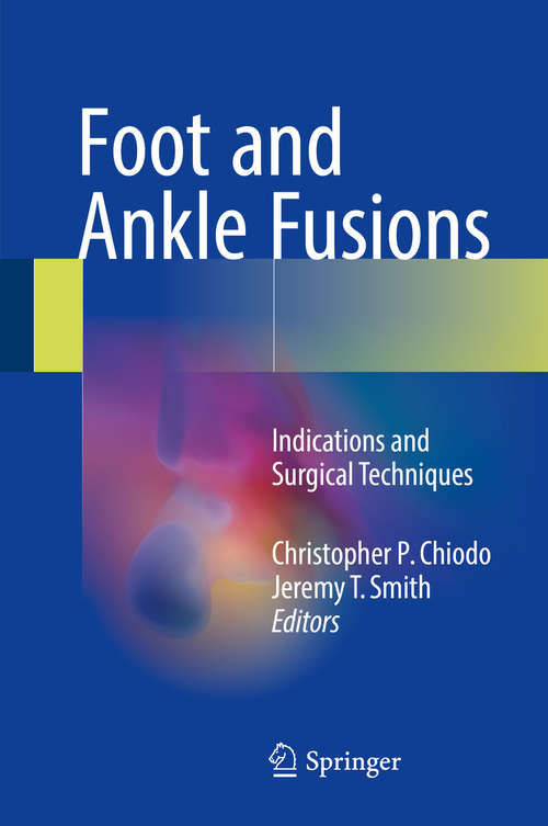 Book cover of Foot and Ankle Fusions: Indications and Surgical Techniques