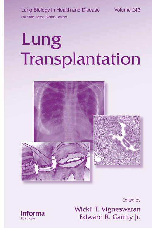 Book cover of Lung Transplantation