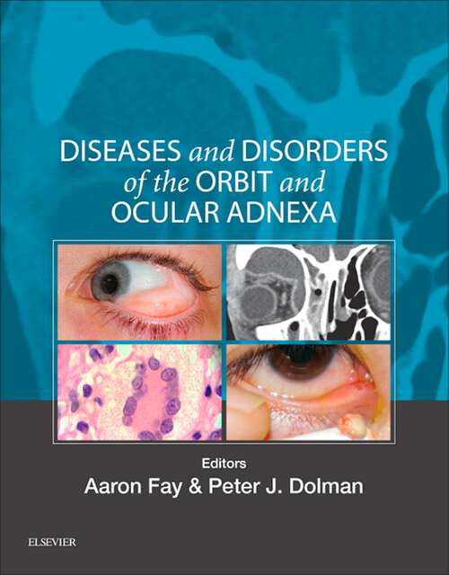 Book cover of Diseases and Disorders of the Orbit and Ocular Adnexa E-Book: Expert Consult