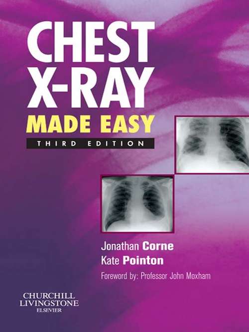 Book cover of Chest X-Ray Made Easy E-Book (3) (Made Easy)