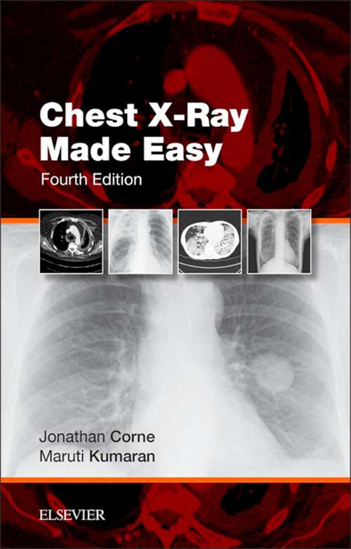 Book cover of Chest X-Ray Made Easy E-Book (3) (Made Easy)