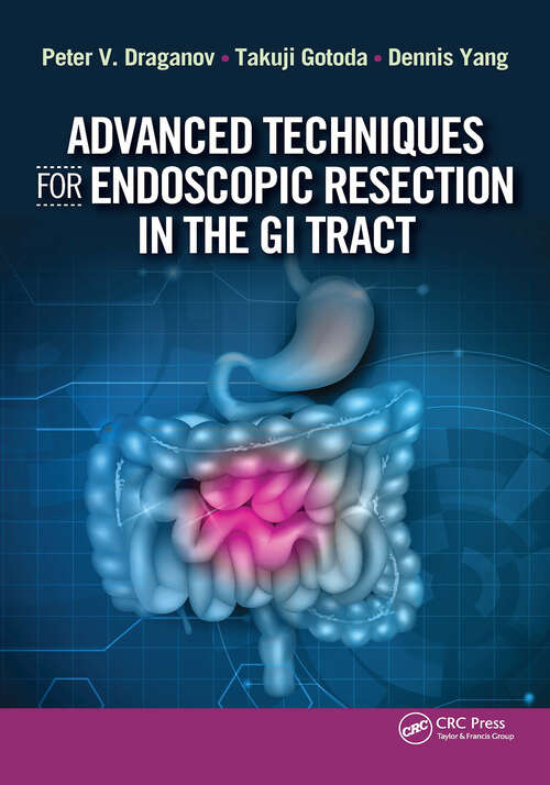 Book cover of Advanced Techniques for Endoscopic Resection in the GI Tract