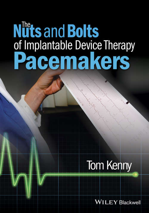 Book cover of The Nuts and Bolts of Implantable Device Therapy: Pacemakers (The Nuts and Bolts Series)