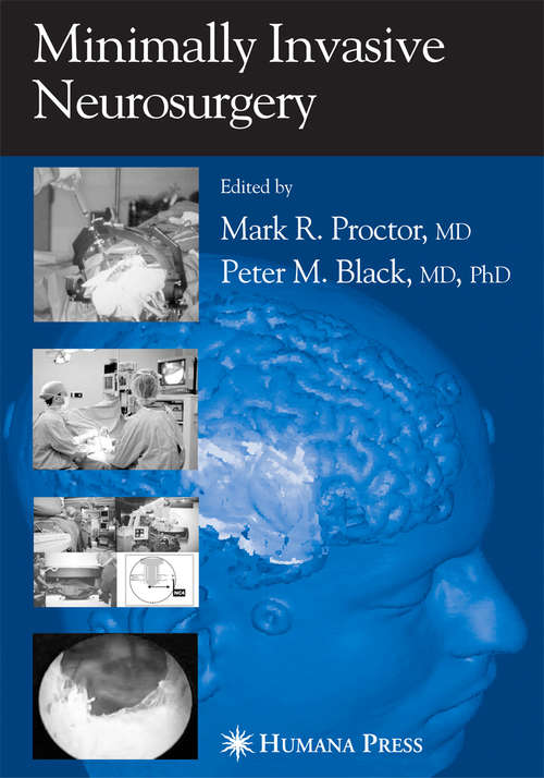 Book cover of Minimally Invasive Neurosurgery (2005)