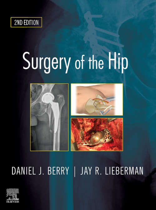 Book cover of Surgery of the Hip E-Book: Expert Consult - Online And Print (2)