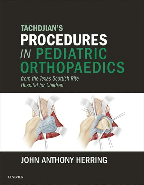 Book cover of Tachdjian's Procedures in Pediatric Orthopaedics: From the Texas Scottish Rite Hospital for Children E-Book