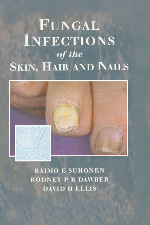 Book cover of Fungal Infections of the Skin and Nails