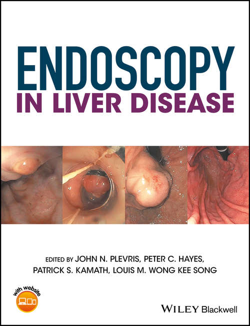 Book cover of Endoscopy in Liver Disease