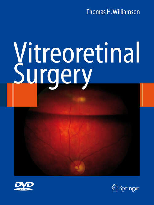 Book cover of Vitreoretinal Surgery (2008)