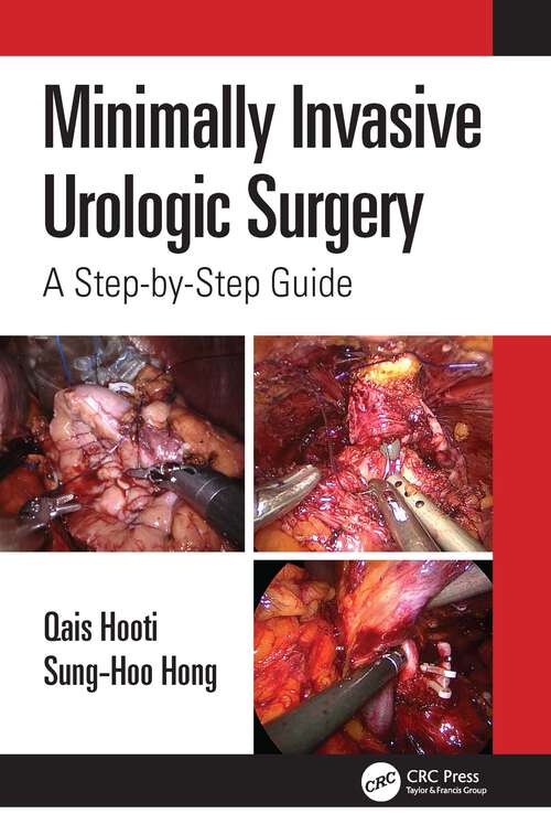 Book cover of Minimally Invasive Urologic Surgery: A Step-by-Step Guide