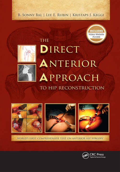 Book cover of The Direct Anterior Approach to Hip Reconstruction (2)