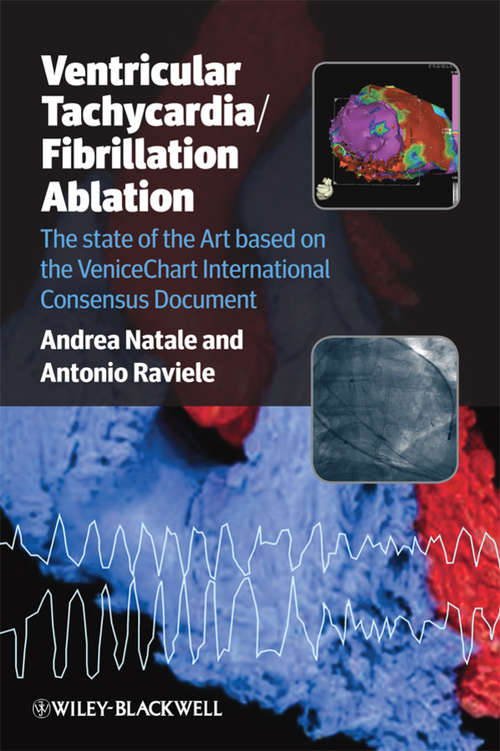 Book cover of Ventricular Tachycardia / Fibrillation Ablation: The state of the Art based on the VeniceChart International Consensus Document (2)