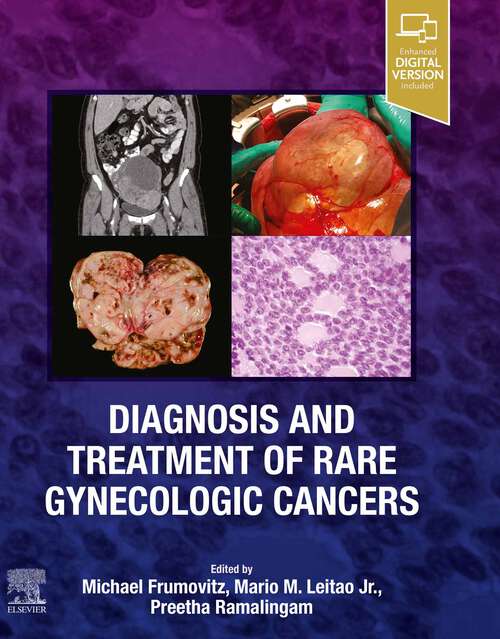 Book cover of Diagnosis and Treatment of Rare Gynecologic Cancers - E-Book