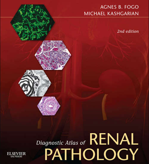 Book cover of Diagnostic Atlas of Renal Pathology E-Book (2)