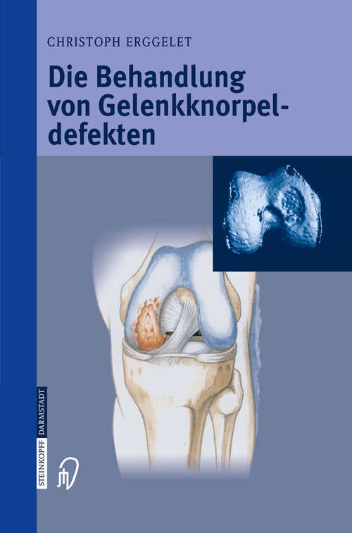 Book cover of Die Behandlung von Gelenkknorpeldefekten (2004)