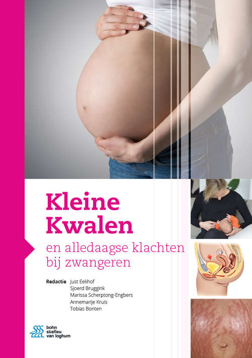 Book cover of Kleine Kwalen en alledaagse klachten bij zwangeren (1st ed. 2020)