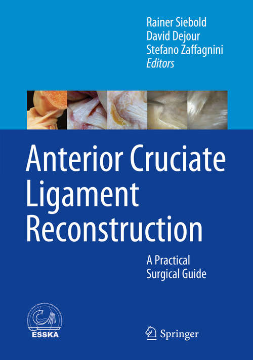 Book cover of Anterior Cruciate Ligament Reconstruction: A Practical Surgical Guide (2014)