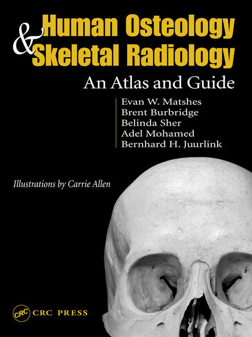 Book cover of Human Osteology and Skeletal Radiology: An Atlas and Guide