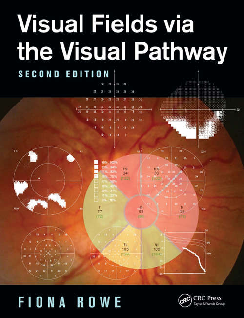 Book cover of Visual Fields via the Visual Pathway (2)