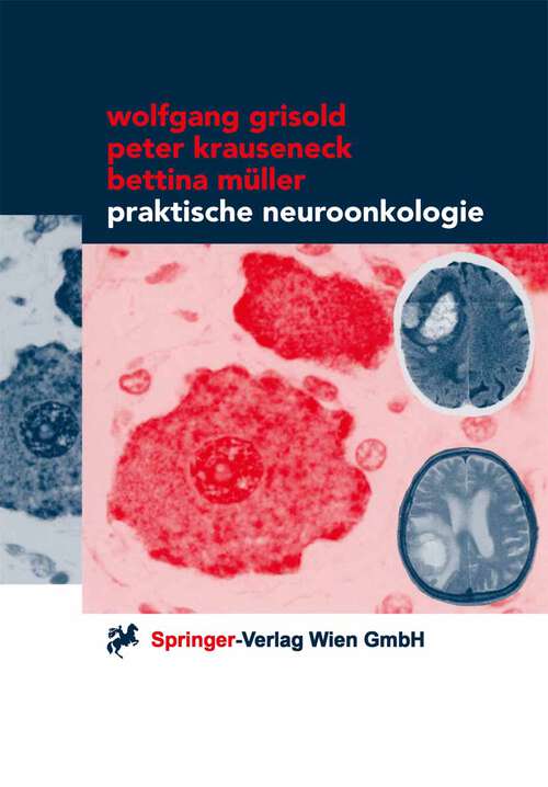 Book cover of Praktische Neuroonkologie (2000)