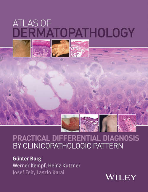 Book cover of Atlas of Dermatopathology: Practical Differential Diagnosis by Clinicopathologic Pattern