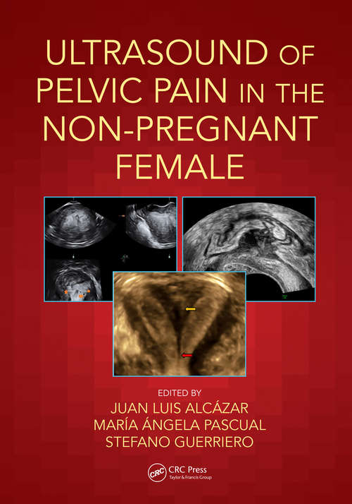 Book cover of Ultrasound of Pelvic Pain in the Non-Pregnant Patient