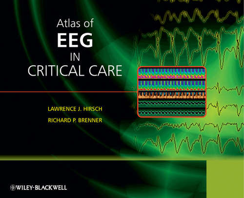 Book cover of Atlas of EEG in Critical Care