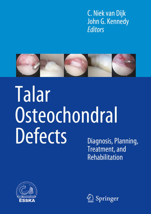 Book cover of Talar Osteochondral Defects: Diagnosis, Planning, Treatment, and Rehabilitation (2014)